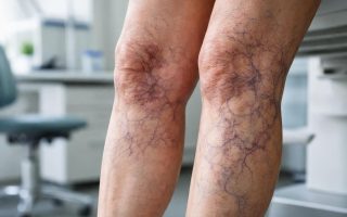 jambes-marbrees-arriere-plan-medical